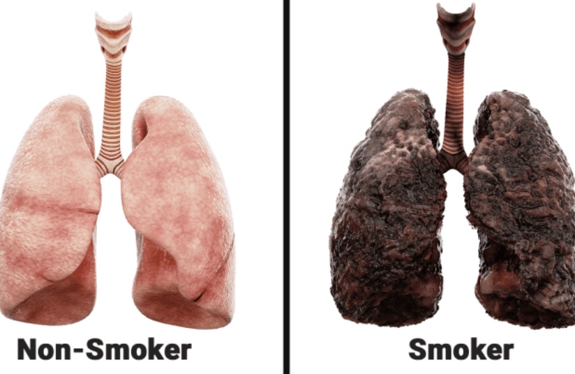 Can a smoker’s lungs heal after a period of smoking cessation?