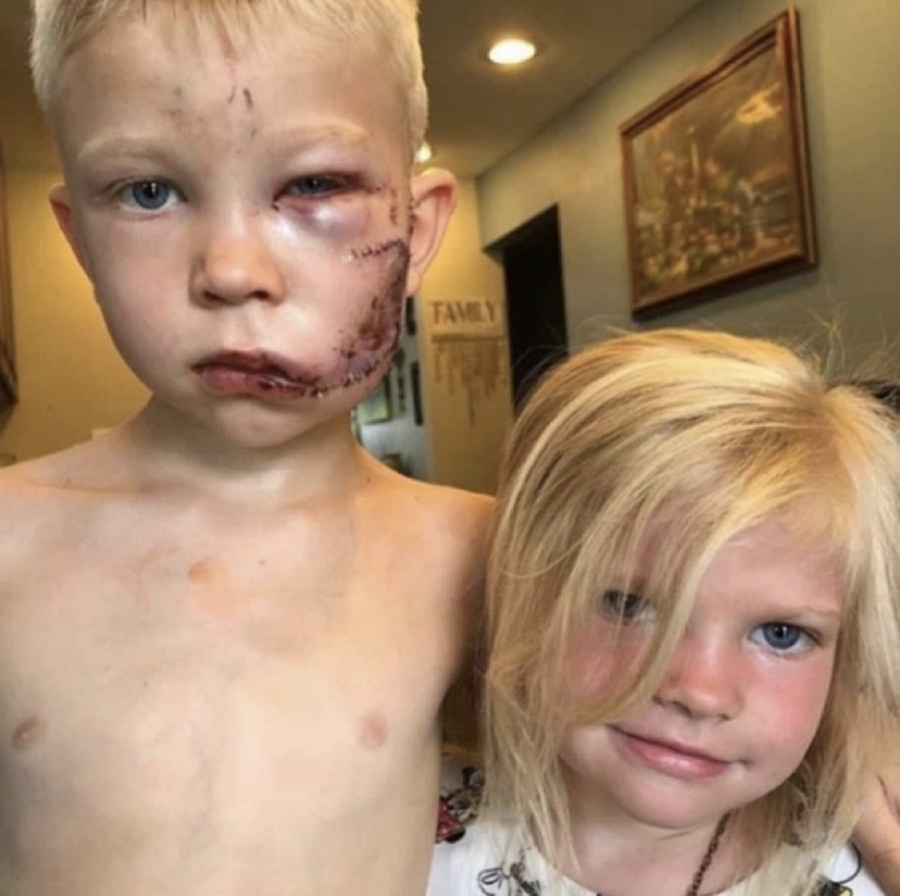 Six-year-old Bridger from Cheyenne, Wyoming, saved his sister from an attacking dog on July 9.